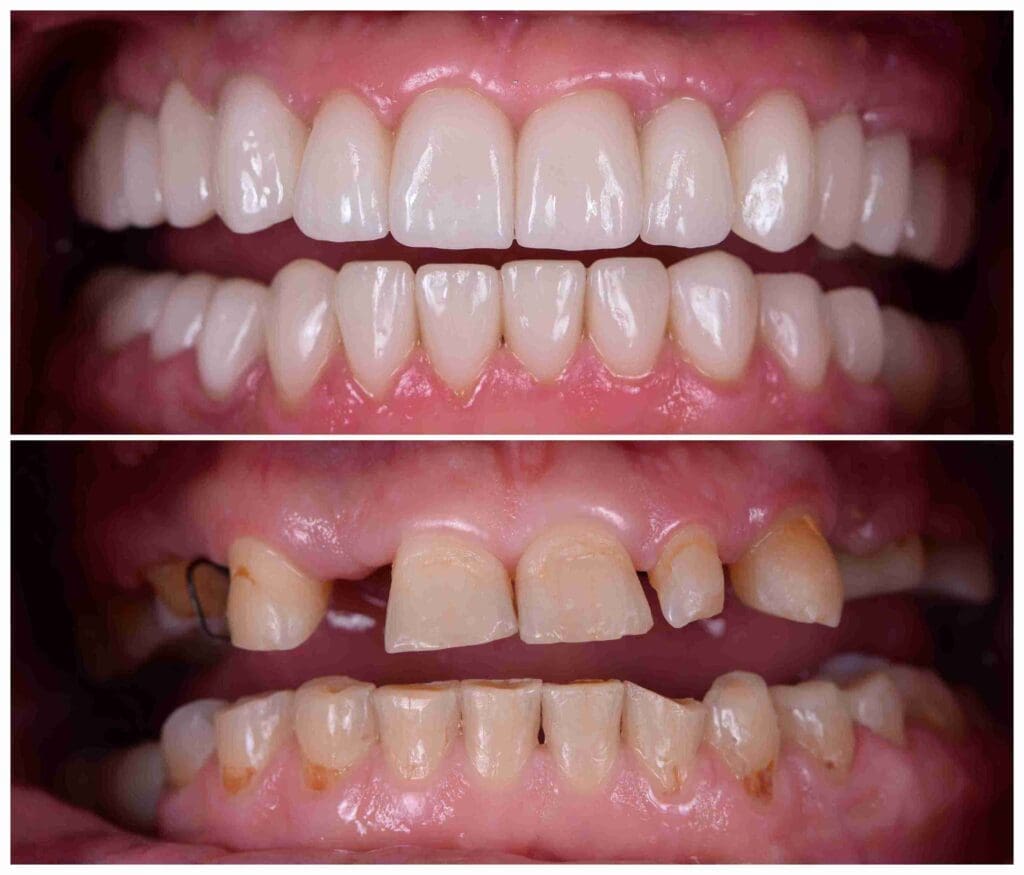 Professional cosmetic dentist Dr. Nova Aghbashian in Glendale, CA 91202, providing smile transformations and aesthetic dental care at Aghbashian Dental.