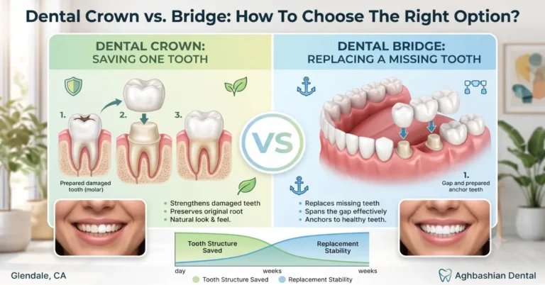 Illustration comparing a dental crown versus a dental bridge by Aghbashian Dental.
